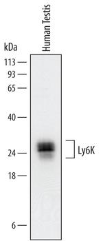 LY6K Antibody in Western Blot (WB)