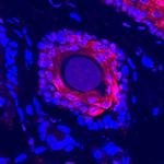 DARC Polyclonal Antibody