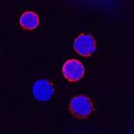 IFNGR1 Polyclonal Antibody