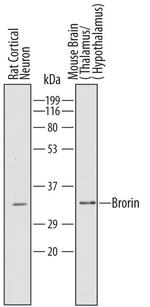 VWC2 Antibody in Western Blot (WB)