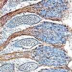 FGF15 Polyclonal Antibody