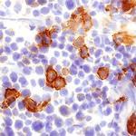 CLEC9A Polyclonal Antibody