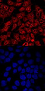IRF2BP1 Antibody in Immunocytochemistry (ICC/IF)