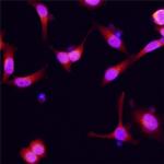 Dynactin 2 Polyclonal Antibody