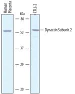 Dynactin 2 Antibody in Western Blot (WB)