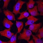 Folate Receptor alpha Polyclonal Antibody