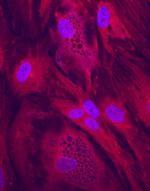 CLTCL1 Polyclonal Antibody