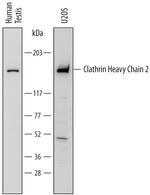 CLTCL1 Antibody in Western Blot (WB)