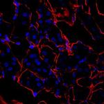 Hemopexin Polyclonal Antibody
