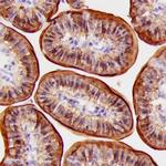 FABP1 Polyclonal Antibody