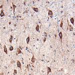 AgRP Polyclonal Antibody