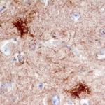 DOCK3 Polyclonal Antibody