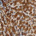 GALNT1 Polyclonal Antibody