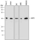 PPP1R8 Polyclonal Antibody