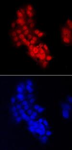 CHD7 Polyclonal Antibody