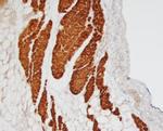 MYBPC3 Polyclonal Antibody