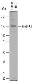 MYBPC3 Antibody in Western Blot (WB)