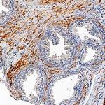 TMEM219 Polyclonal Antibody