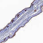 IL1R1 Polyclonal Antibody