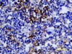 IGF2 Polyclonal Antibody