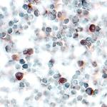 PPBP Polyclonal Antibody