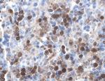 XIAP Antibody in Immunohistochemistry (Paraffin) (IHC (P))