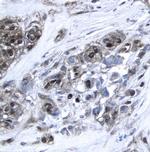 XIAP Polyclonal Antibody