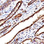 Cathepsin L Polyclonal Antibody