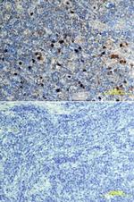 CXCL16 Polyclonal Antibody