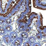 GAS6 Polyclonal Antibody