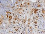BMP-3 Polyclonal Antibody