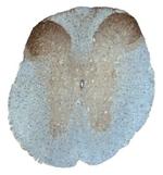 TMEFF1 Antibody in Immunohistochemistry (Frozen) (IHC (F))