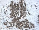 CHRDL2 Polyclonal Antibody