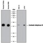 Carbonic Anhydrase VI Polyclonal Antibody
