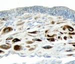 ADAMTS1 Polyclonal Antibody