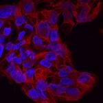 DISP1 Polyclonal Antibody