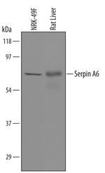 SERPINA6 Polyclonal Antibody