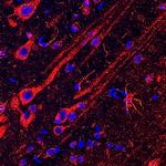 N-WASP Polyclonal Antibody