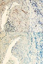 TSKU Polyclonal Antibody
