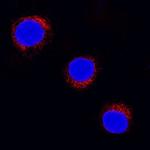 SOCS5 Polyclonal Antibody