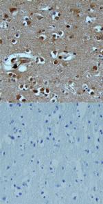 TAFA1 Polyclonal Antibody
