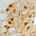 FSTL4 Polyclonal Antibody