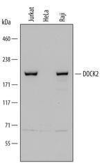 DOCK2 Polyclonal Antibody