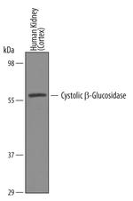 GBA3 Polyclonal Antibody