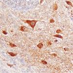 VWC2 Polyclonal Antibody