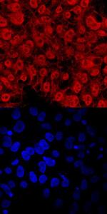 TEX19 Polyclonal Antibody