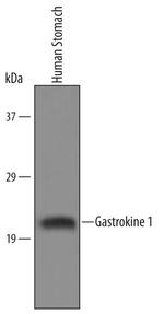 GKN1 Antibody in Western Blot (WB)