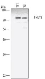 PPP1R10 Antibody in Western Blot (WB)