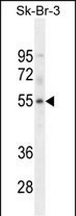WDR21B Polyclonal Antibody