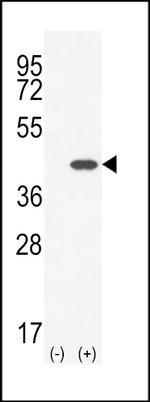 CLEC11A Antibody in Western Blot (WB)